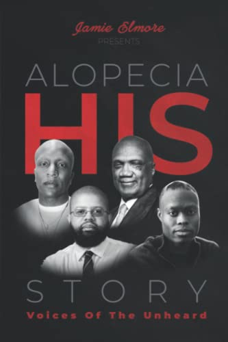 Alopecia: His Story