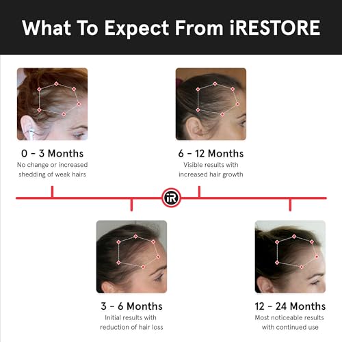 iRestore Professional Laser Hair Growth System + Rechargeable Battery Pack - FDA Cleared Laser Cap for Hair Growth Treatment for Men and Hair Regrowth for Women for Thinning Hair, Hair Loss Products