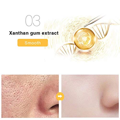 24k Gold Foil Essence Serum, Moisturizing Anti-Aging Anti-Redness Acne Treatment Essence Cream, Face Skin Gold Essence Serum Nicotinamide(30ml/1 ounce)