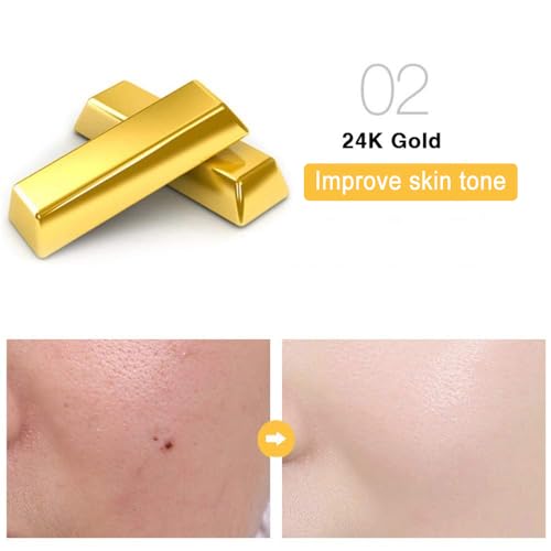 24k Gold Foil Essence Serum, Moisturizing Anti-Aging Anti-Redness Acne Treatment Essence Cream, Face Skin Gold Essence Serum Nicotinamide(30ml/1 ounce)