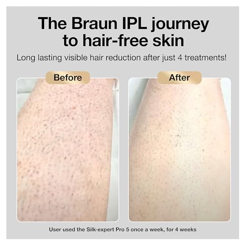 Braun IPL Long-lasting Laser Hair Removal Device for Women & Men, Silk Expert Pro5 PL5157, Safe & Virtually Painless Alternative to Salon Laser Hair Removal, Full Body, With Venus Razor & Luxury Case