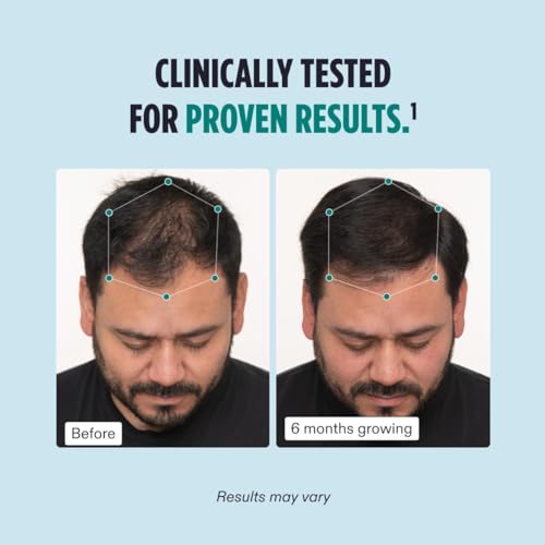 Nutrafol Men's Hair Growth Supplements, Clinically Tested for Visibly Thicker Hair and Scalp Coverage, Dermatologist Recommended - 2 Month Supply, 2 Refill Pouches