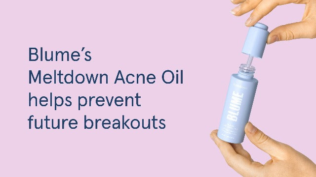 Blume Meltdown Acne Oil - Acne Treatment Face Oil + Pore Minimizer - Skin-Smoothing Face Serum with Rosehip Oil, Blue Tansy and Black Cumin Seed Oil - Helps Calm Redness and Improve Texture (0.5 oz)