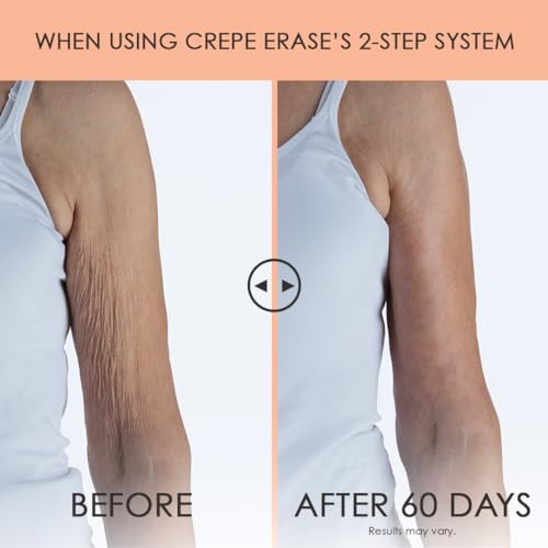 Crepe Erase Advanced Body Repair Treatment, Anti-Aging Wrinkle Cream for Face and Body, Support Skins Natural Elastin & Collagen Production - 10oz