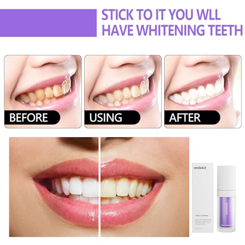 Purple Toothpaste for Teeth Whitening, Teeth Whitening Purple Toothpaste (30ml), Purple Toothpaste, Purple Teeth Whitening, Colour Correcting, Tooth Colour Corrector