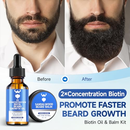 Beard Growth Oil & Beard Balm - Beard Growth Kit with 2X Concentration Biotin for Men, Natural Ingredients with Argan Oil, Jojoba Oil and Vitamin E