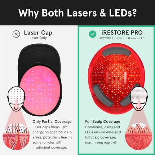 iRestore Professional 282 | FDA Cleared Laser Hair Growth Device | Red Light Therapy for Hair Growth | Laser Cap for Hair Regrowth, Restore Laser Helmet, Hair Loss Treatments for Men & Women Alopecia