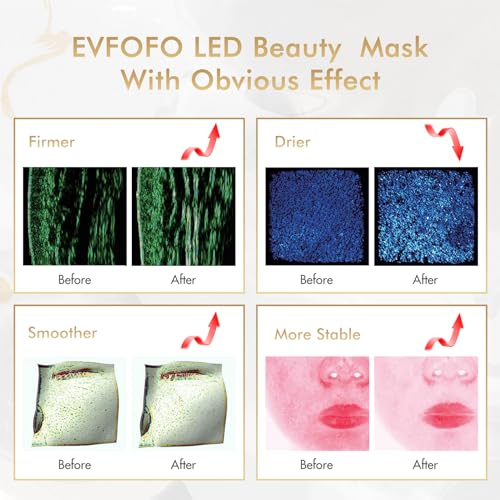 7 Colors LED Face Mask Light Therapy, Led Face Mask Light Therapy At Home, Blue Red Light Therapy Mask for Face