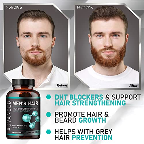 Hair Growth Vitamins For Men - Anti Hair Loss Pills. Regrow Hair & Beard Growth Supplement For Volumize, Thicker Hair.Stop Hair Loss And Thinning Hair With Biotin & Saw Palmetto Hair Vitamins.120 Caps