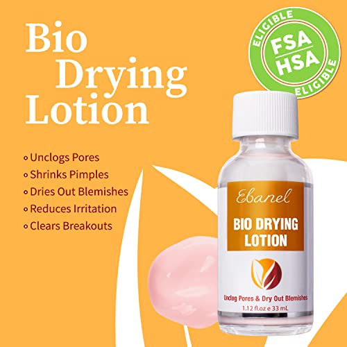 Ebanel Acne Drying Lotion, Overnight Salicylic Acid and Sulfur Cystic Acne Spot Treatment for Face and Body, Pimple Cream Spot Treatment, Dries Out Pimples, Cysts, Blemishes, Zits, and Clogged Pores